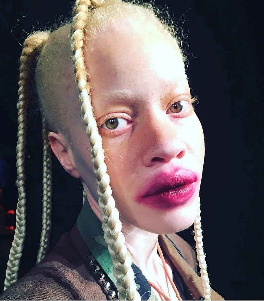 Африканская девушка-альбинос наделала шума в мире моды - фото 332841
