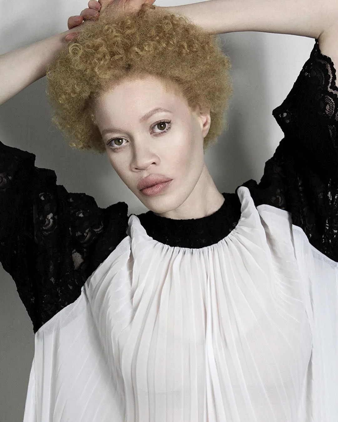 Африканская девушка-альбинос наделала шума в мире моды - фото 332843
