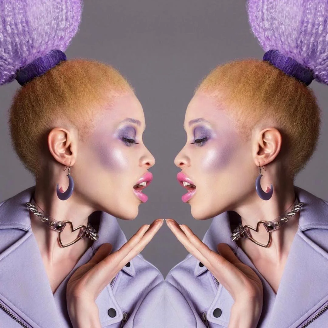 Африканская девушка-альбинос наделала шума в мире моды - фото 332850
