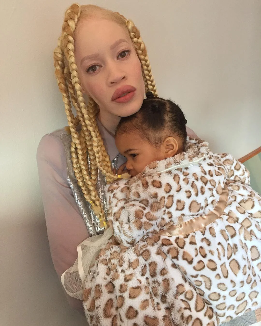 Африканская девушка-альбинос наделала шума в мире моды - фото 332840