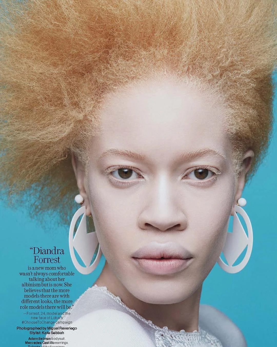 Африканская девушка-альбинос наделала шума в мире моды - фото 332855