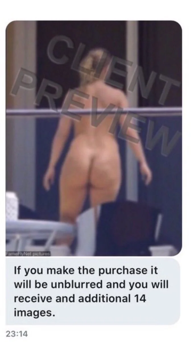Співачка Sia шокувала мережу фотографією оголених сідниць - фото 349434
