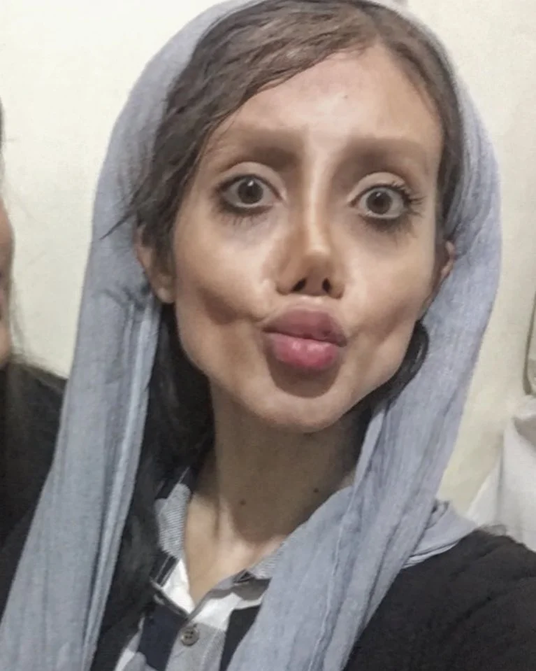 Страшная кукла: женщина сделала 50 пластических операций, чтобы стать Анджелиной Джоли - фото 354574