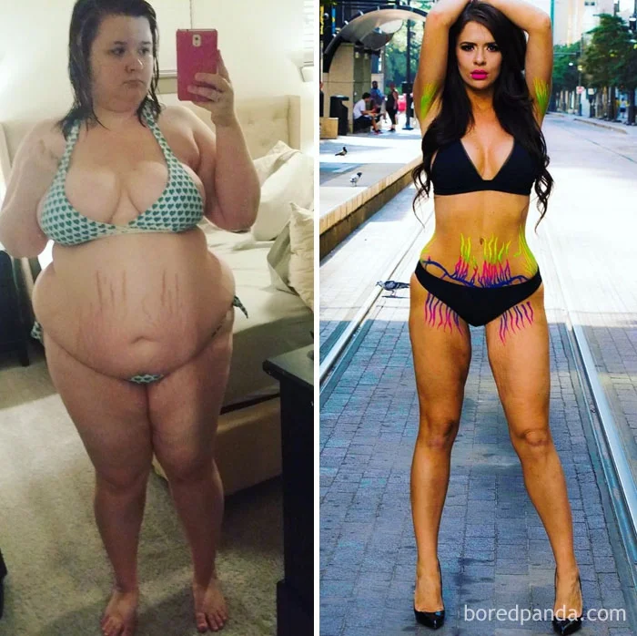 Впечатляющие фото людей 'до' и 'после' похудения, которые вдохновляют заняться собой - фото 348830