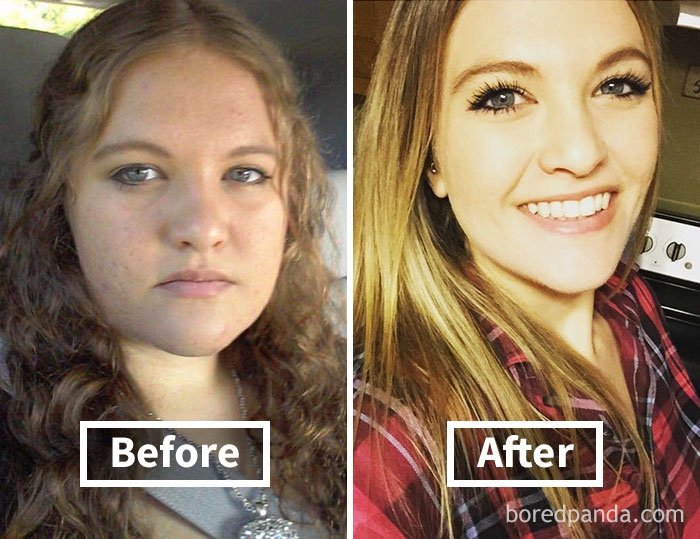 Фантастические фото показывают, как меняются лица людей, когда они худеют - фото 357905