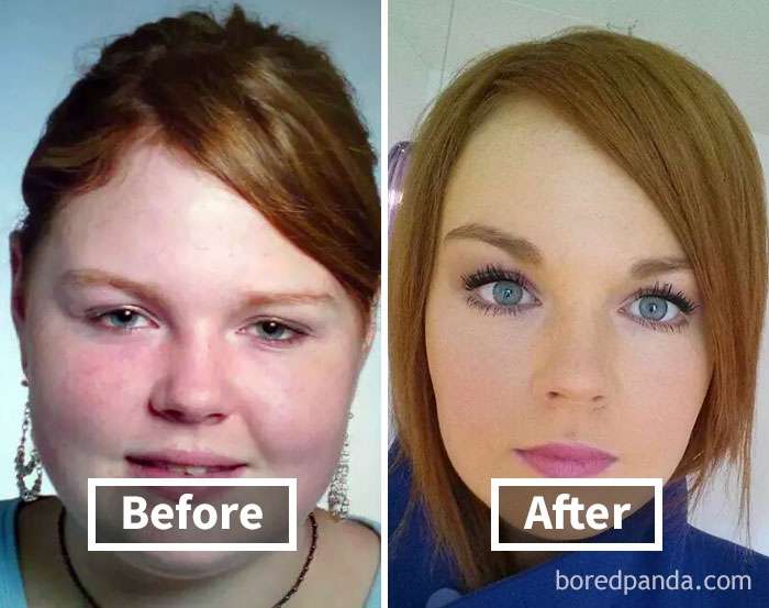 Фантастичні фото показують, як змінюються обличчя людей, коли вони худнуть - фото 357898