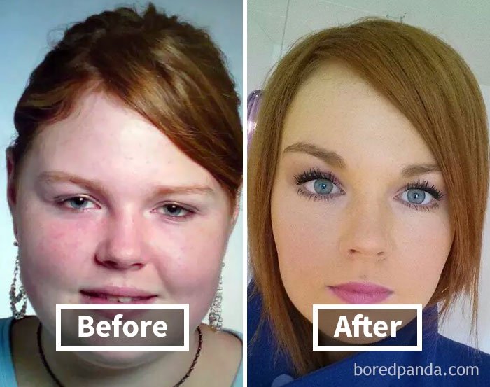 Фантастические фото показывают, как меняются лица людей, когда они худеют - фото 357898