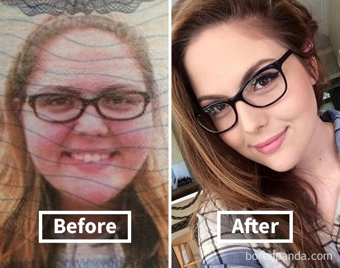 Фантастические фото показывают, как меняются лица людей, когда они худеют - фото 357904