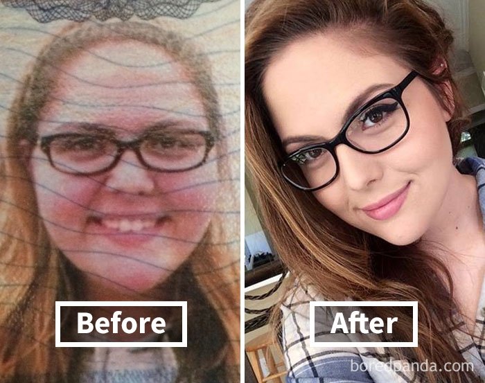 Фантастичні фото показують, як змінюються обличчя людей, коли вони худнуть - фото 357904