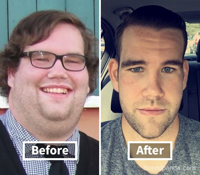 Фантастические фото показывают, как меняются лица людей, когда они худеют - фото 357902