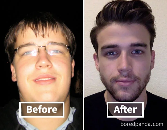 Фантастичні фото показують, як змінюються обличчя людей, коли вони худнуть - фото 357889