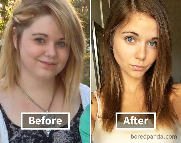 Фантастичні фото показують, як змінюються обличчя людей, коли вони худнуть - фото 357900