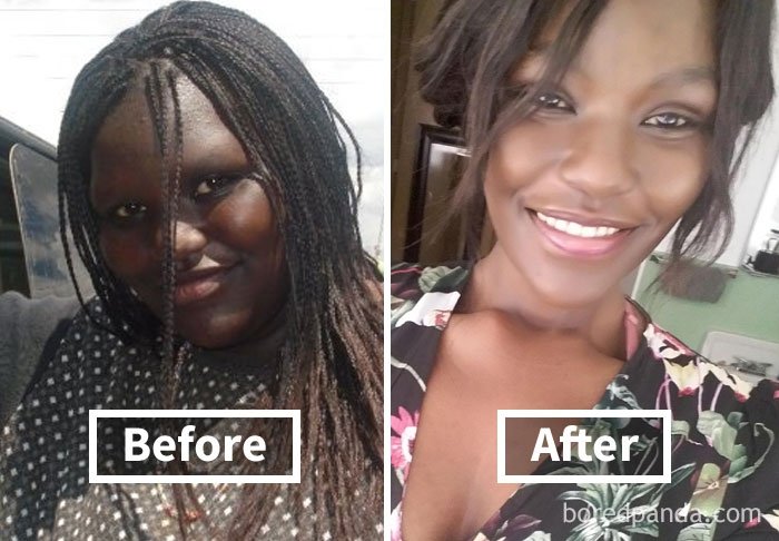 Фантастические фото показывают, как меняются лица людей, когда они худеют - фото 357894