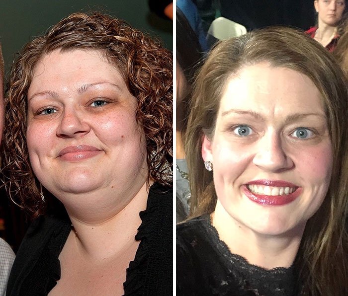 Фантастическое превращение: женщина похудела на 70 килограммов, и вот, как ей это удалось - фото 375631