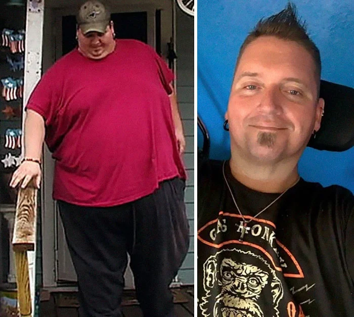 Фото людей,похудевших на 200 килограммов, шокируют и доказывают, что нет невозможного - фото 381927