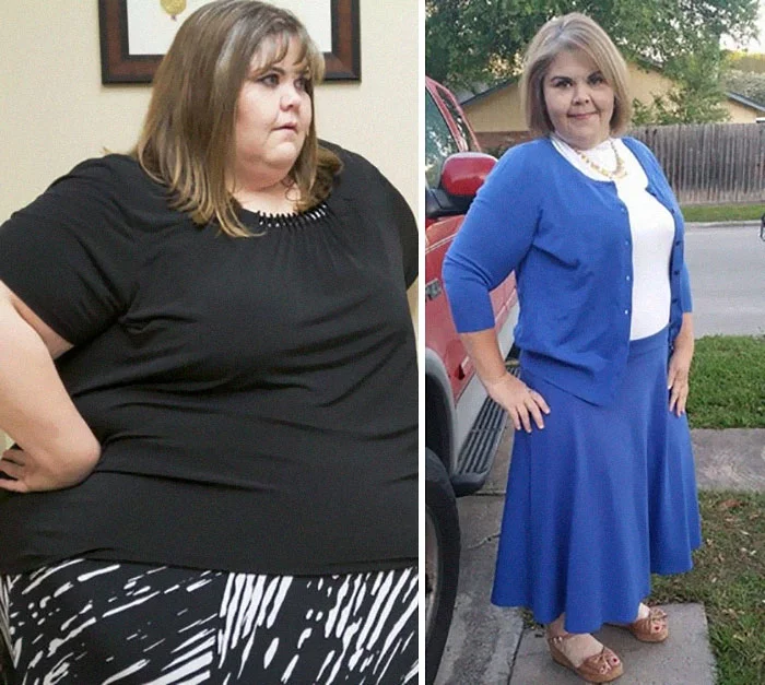Фото людей, які схудли на 200 кілограмів, шокують і доводять, що нема нічого неможливого - фото 381930