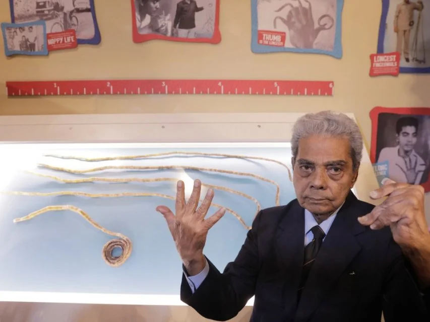 Мужчине из Индии обрезали самые длинные в мире ногти - фото 393191