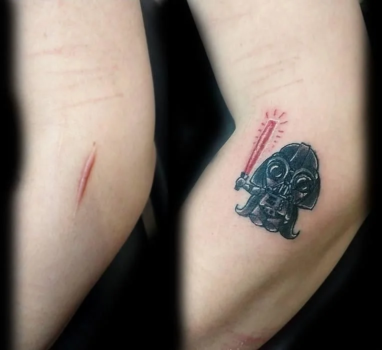 Не прихоть, а необходимость: 10 креативных татуировок, которые перекроют шрамы на теле - фото 419247