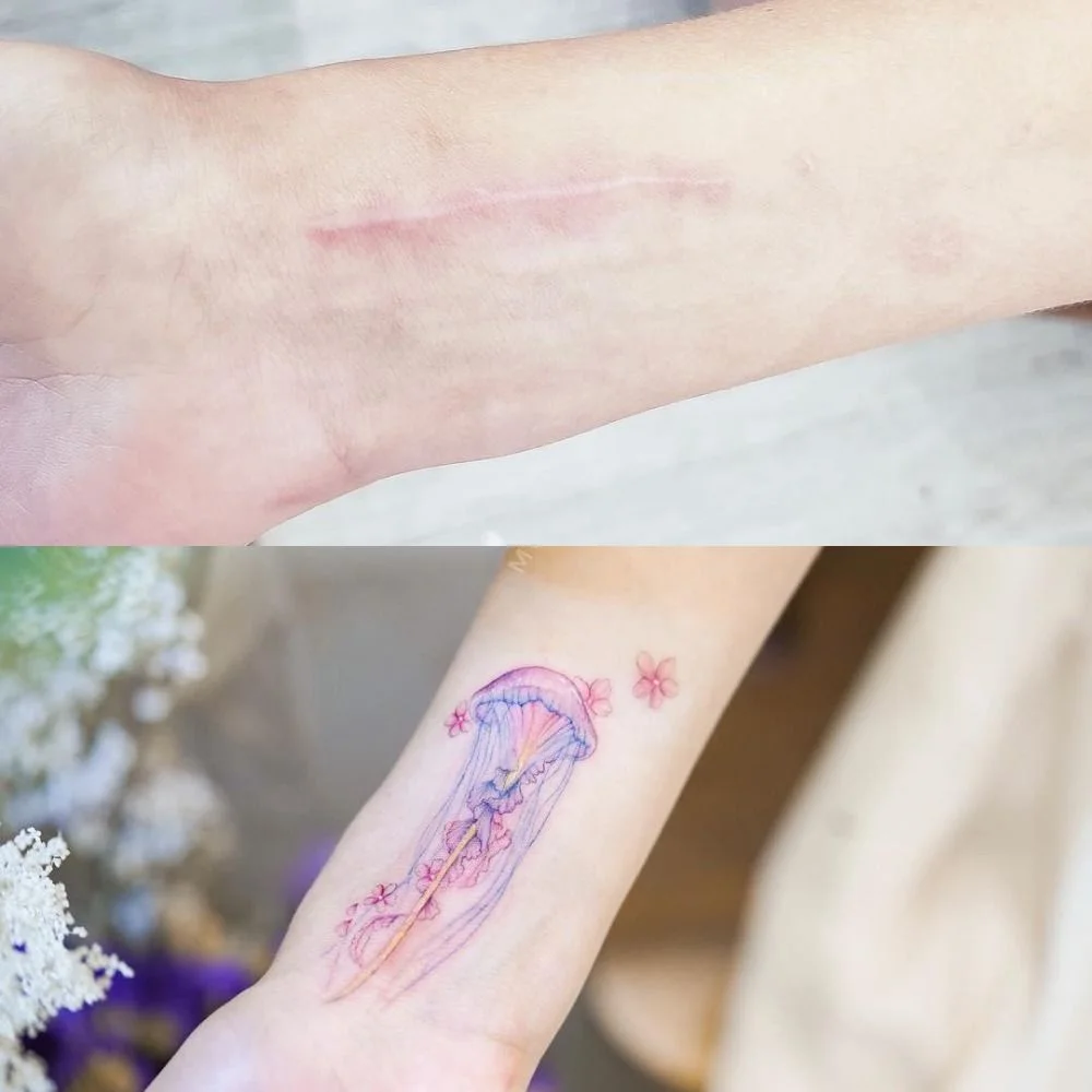 Не прихоть, а необходимость: 10 креативных татуировок, которые перекроют шрамы на теле - фото 419252