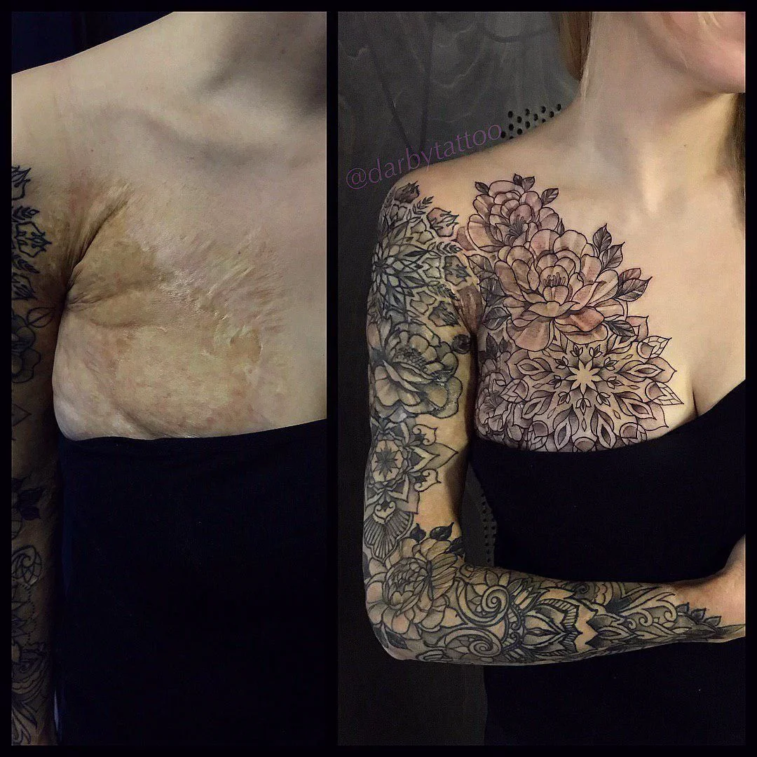 Не прихоть, а необходимость: 10 креативных татуировок, которые перекроют шрамы на теле - фото 419254