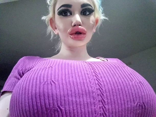 Капля трэша: девушка сделала гигантские губы и считает себя барби - фото 477352