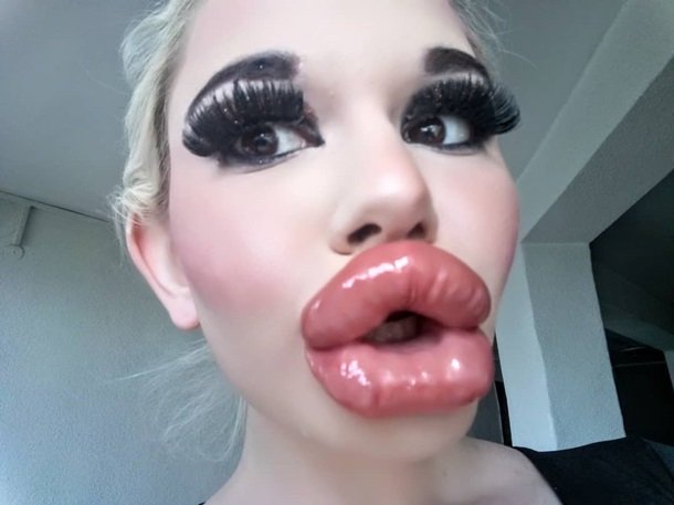 Капля трэша: девушка сделала гигантские губы и считает себя барби - фото 477353