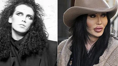 Звёзды, пострадавшие от пластической хирургии