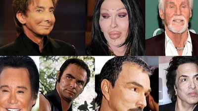 Відомі музиканти, які понівечили себе пластичними операціями