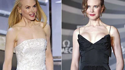 Голлівудські жертви пластичної хірургії