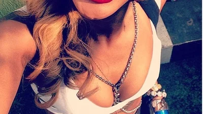 Рианна украсила зубы бриллиантами