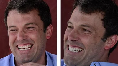 Бен Аффлек розчарував прихильниць своїми зубами