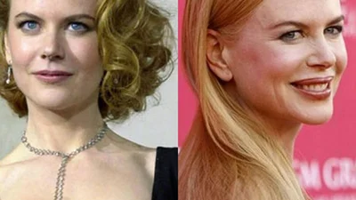 Перестаралися: найневдаліша пластика знаменитостей