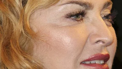 Мадонна и ботокс: правда раскрыта