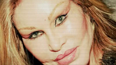 Зірки, які стали жертвами пластичної хірургії