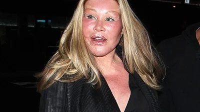 Знамениті жертви пластичної хірургії