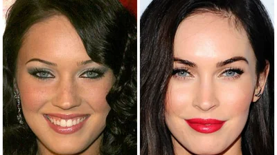 Настоящие лица звезд до пластической хирургии