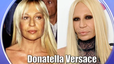 Донателла Версаче: до и после пластики