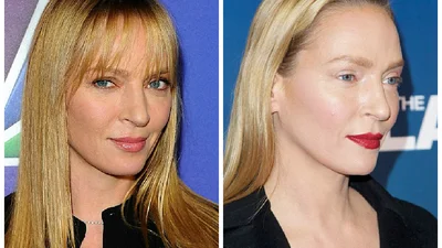 Пластика Умы Турман оказалась неудачным макияжем