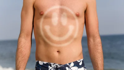 Странная мода: тренд на узоры от солнечного ожога