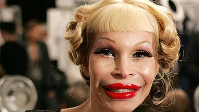 Помилочка вийшла: коли пластична операція виявилася невдалою