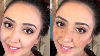 Новая фишка: в моду вошли искусственные веснушки