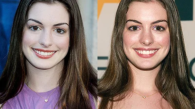 Тогда и сейчас: эволюция красоты актрисы Энн Хэтэуэй