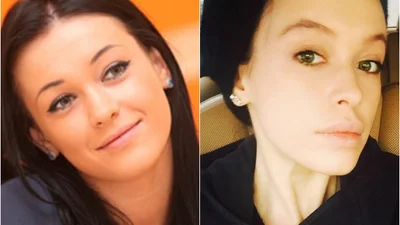 Мария Яремчук перестаралась и перекачала губы