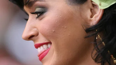 6 привычек, из-за которых у тебя прыщи