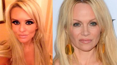 Ця британка витратила $28 тисяч на пластику, щоб стати Памелою Андерсон