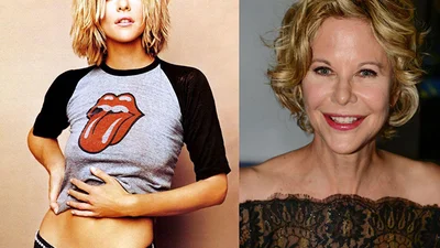 Шокуючі фото зірок після пластичних операцій