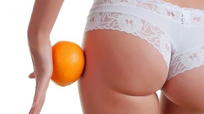 Важка артилерія: боремось з целюлітом в домашніх умовах