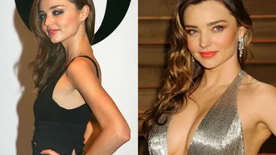 Обережно, фальшивка: зірки, які зробили пластику