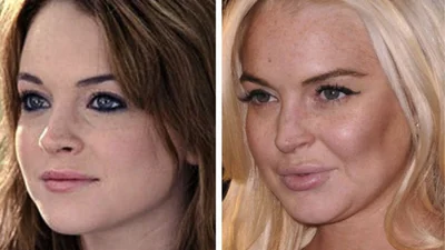 Зірки, які догрались з пластикою