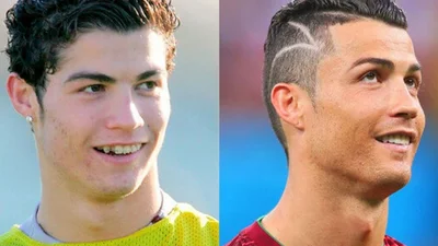 Знайдіть відмінність: зірки до і після пластики